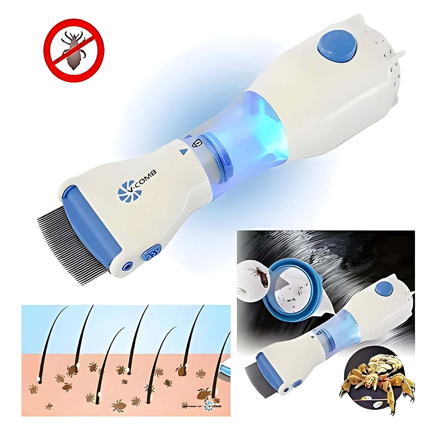 Electric Head Lice Removal
